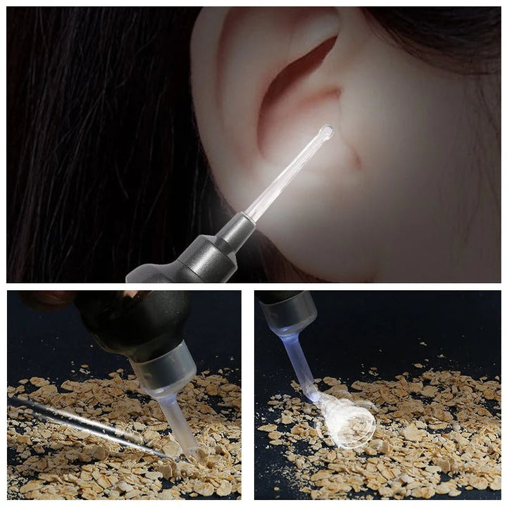 Lisslune | 5 in 1 Electric Earwax Remover