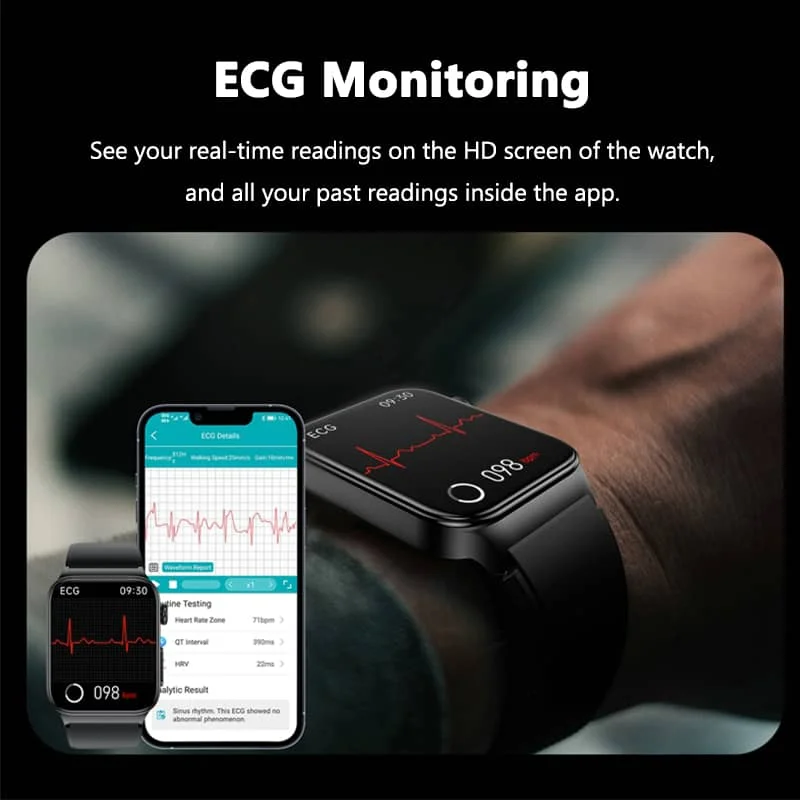Lisslune | All-in-One Health Monitoring Smartwatch with ECG & Blood Glucose Tracker