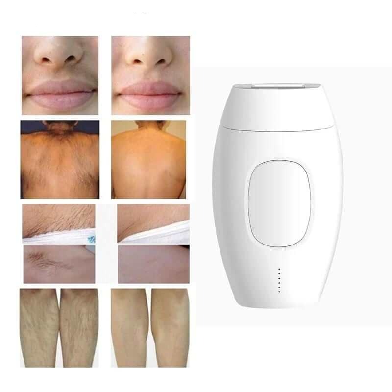 Lisslune | Gladify Pro | Laser Hair Remover | Fast & Painless | Long-term Results