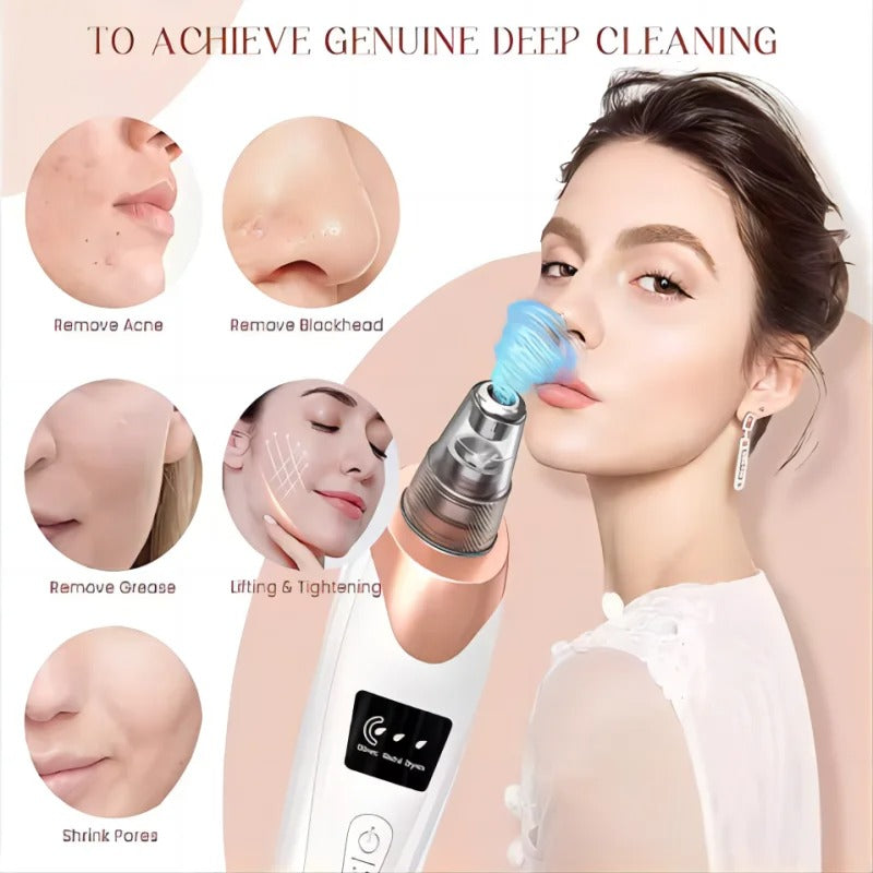 Lisslune | Blackhead Remover Vacuum Pore Cleaner | Adjustable Suction, Multi-Functional Tool for Deep Cleansing & Acne Treatment at Home