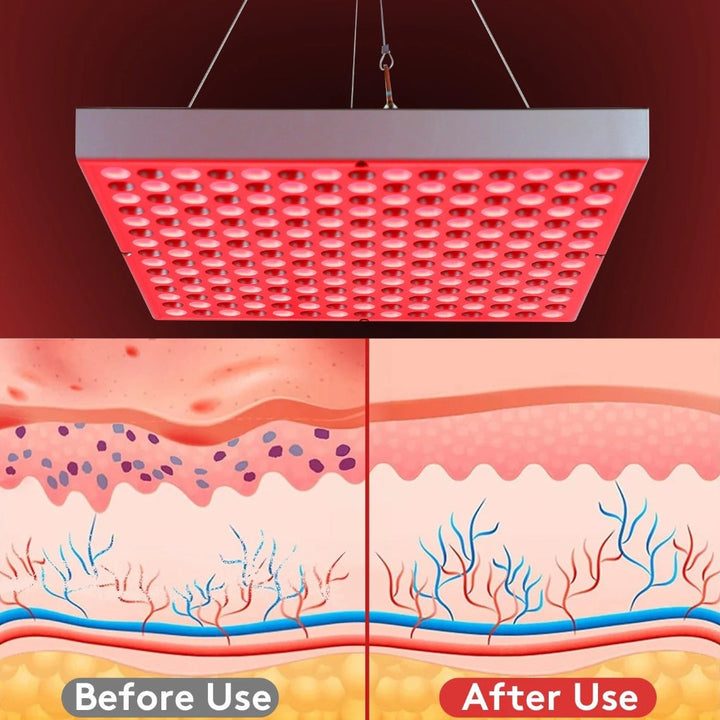 Lisslune | Red Light Therapy Lamp Device  – Muscle Recovery and Sleep Aid