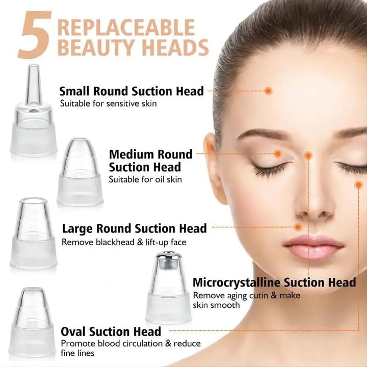 Lisslune | Blackhead Remover Vacuum Pore Cleaner | Adjustable Suction, Multi-Functional Tool for Deep Cleansing & Acne Treatment at Home