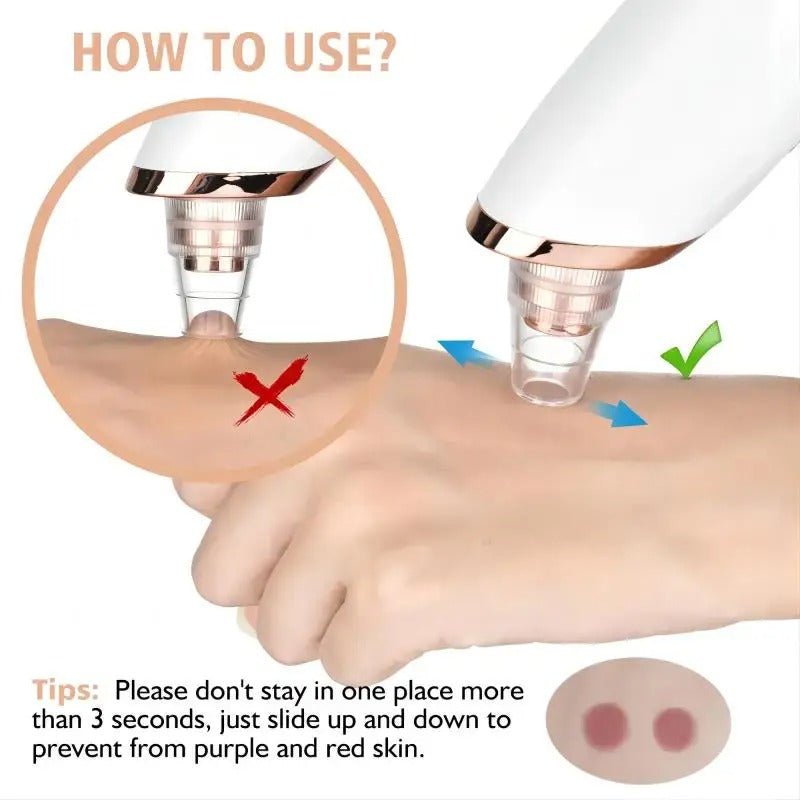 Lisslune | Blackhead Remover Vacuum Pore Cleaner | Adjustable Suction, Multi-Functional Tool for Deep Cleansing & Acne Treatment at Home