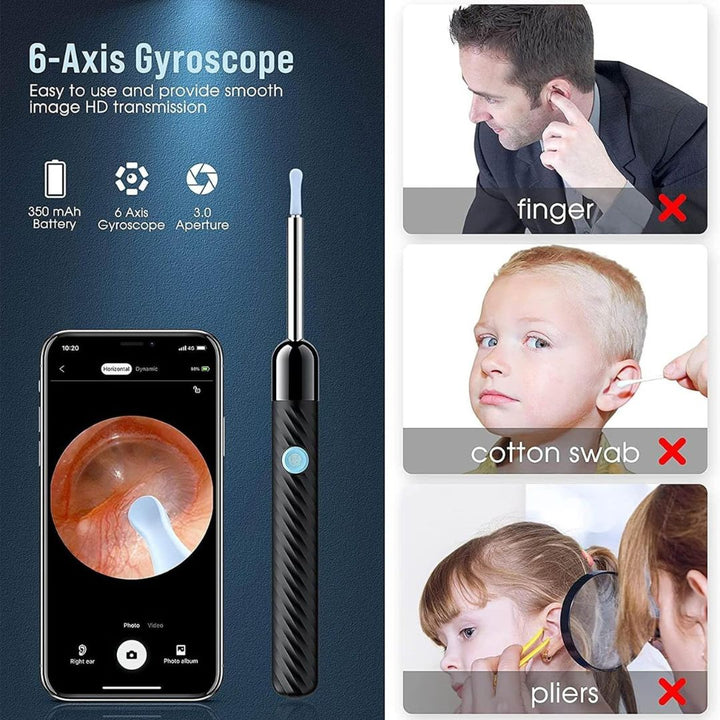 Lisslune | Ear Wax Removal Tool | 1080P HD Camera, LED Lights & Adjustable Scoops for Safe Ear Hygiene at Home