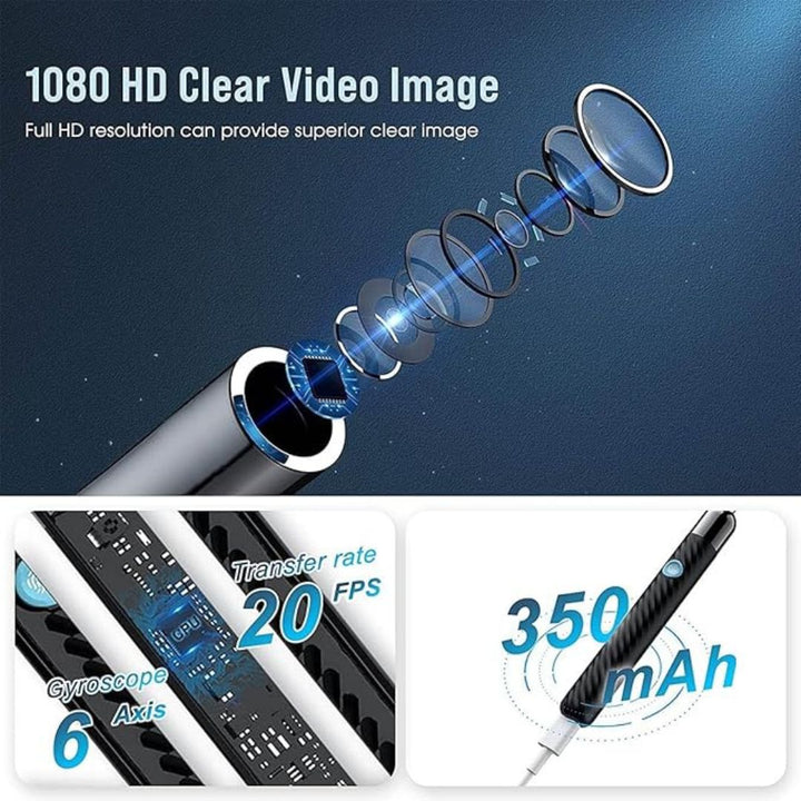 Lisslune | Ear Wax Removal Tool | 1080P HD Camera, LED Lights & Adjustable Scoops for Safe Ear Hygiene at Home