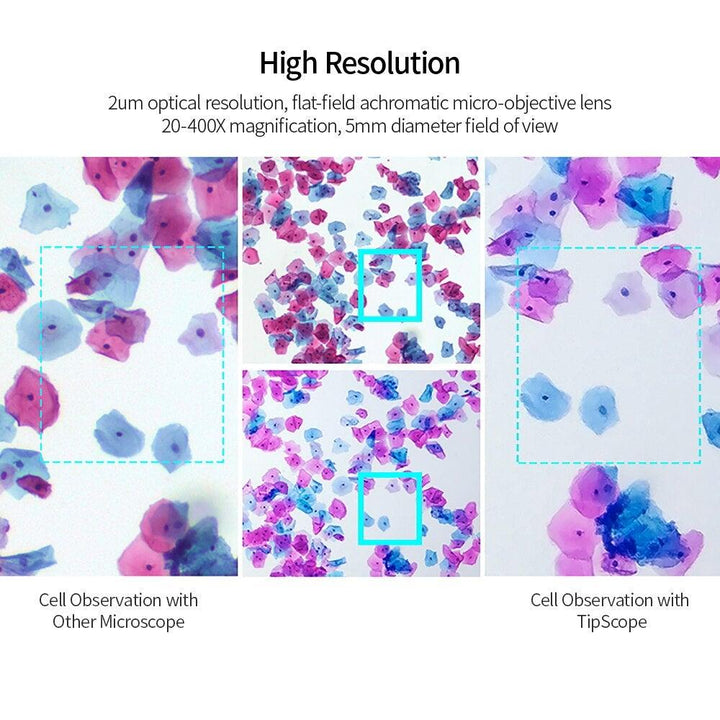 Lisslune | Mobile Phone Microscope