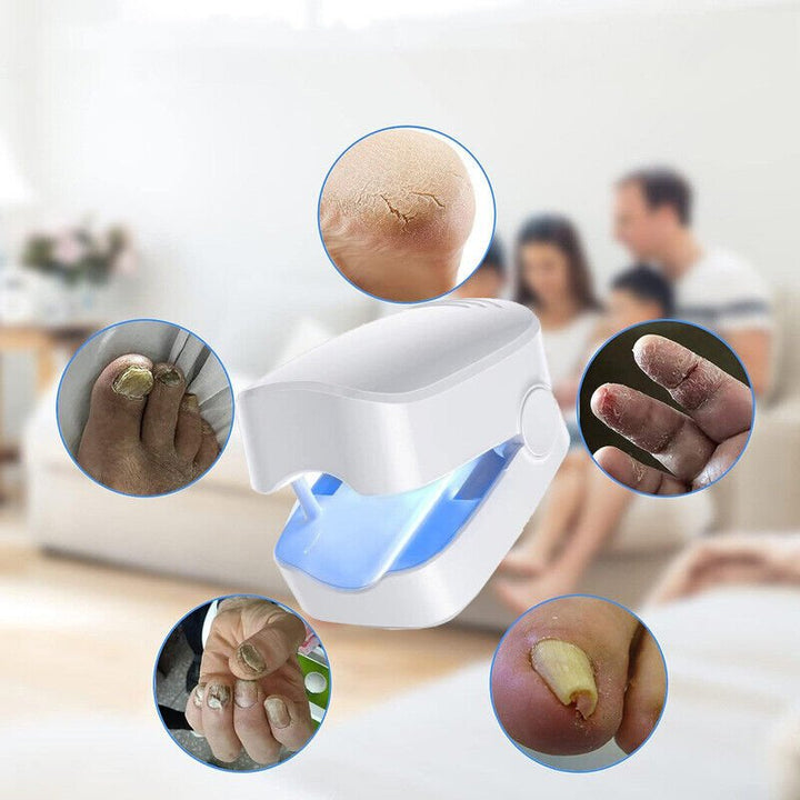 Lisslune | Laser device for nail fungus cleaning – Revolutionary, highly efficient light therapy device from Expert for toe nail conditions