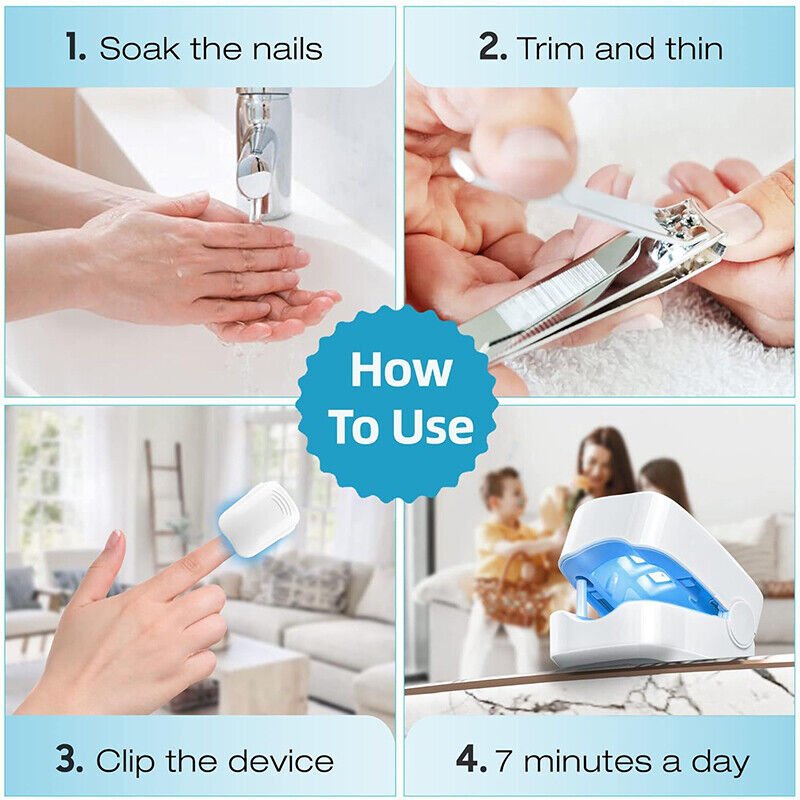 Lisslune | Laser device for nail fungus cleaning – Revolutionary, highly efficient light therapy device from Expert for toe nail conditions