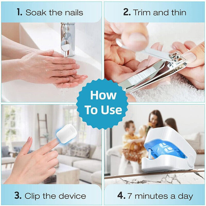 Lisslune | Laser device for nail fungus cleaning – Revolutionary, highly efficient light therapy device from Expert for toe nail conditions