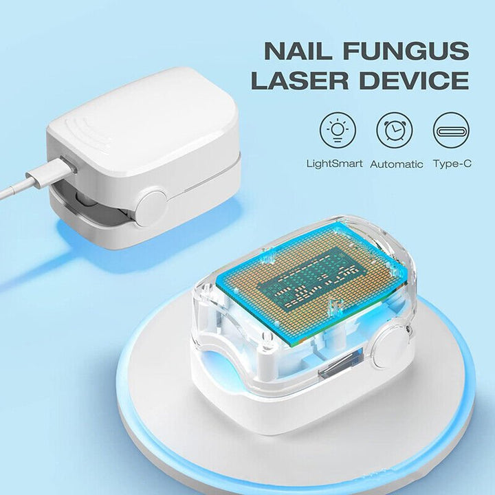 Lisslune | Laser device for nail fungus cleaning – Revolutionary, highly efficient light therapy device from Expert for toe nail conditions