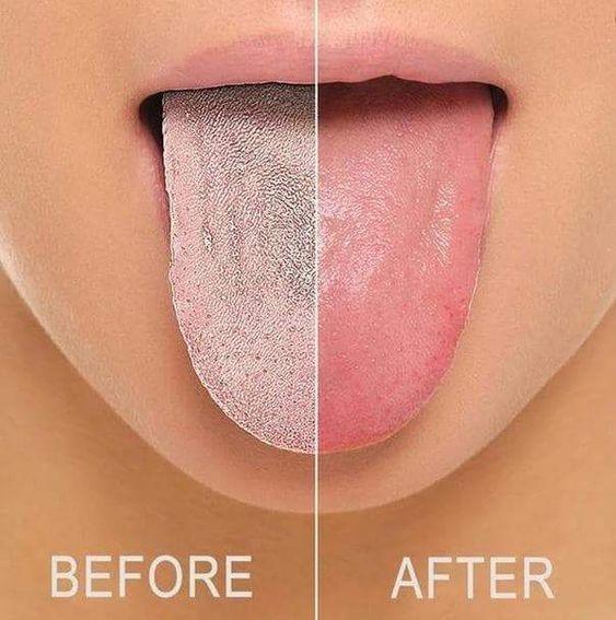 Lisslune | Oral Flex