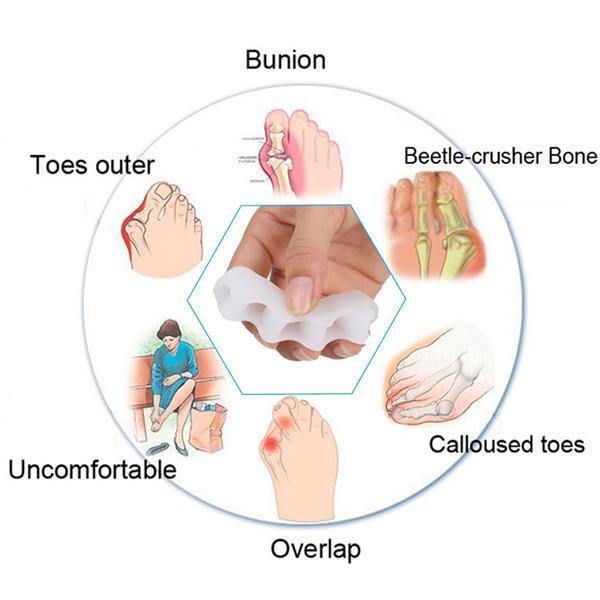 Lisslune | Orthopedic Toe Corrector - Toe Separator