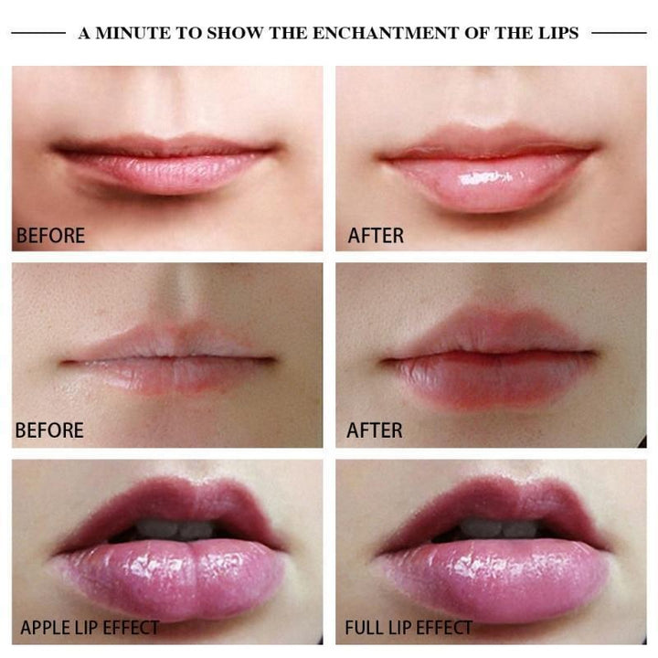 Lisslune | Electric Automatic Lip Plumping Device