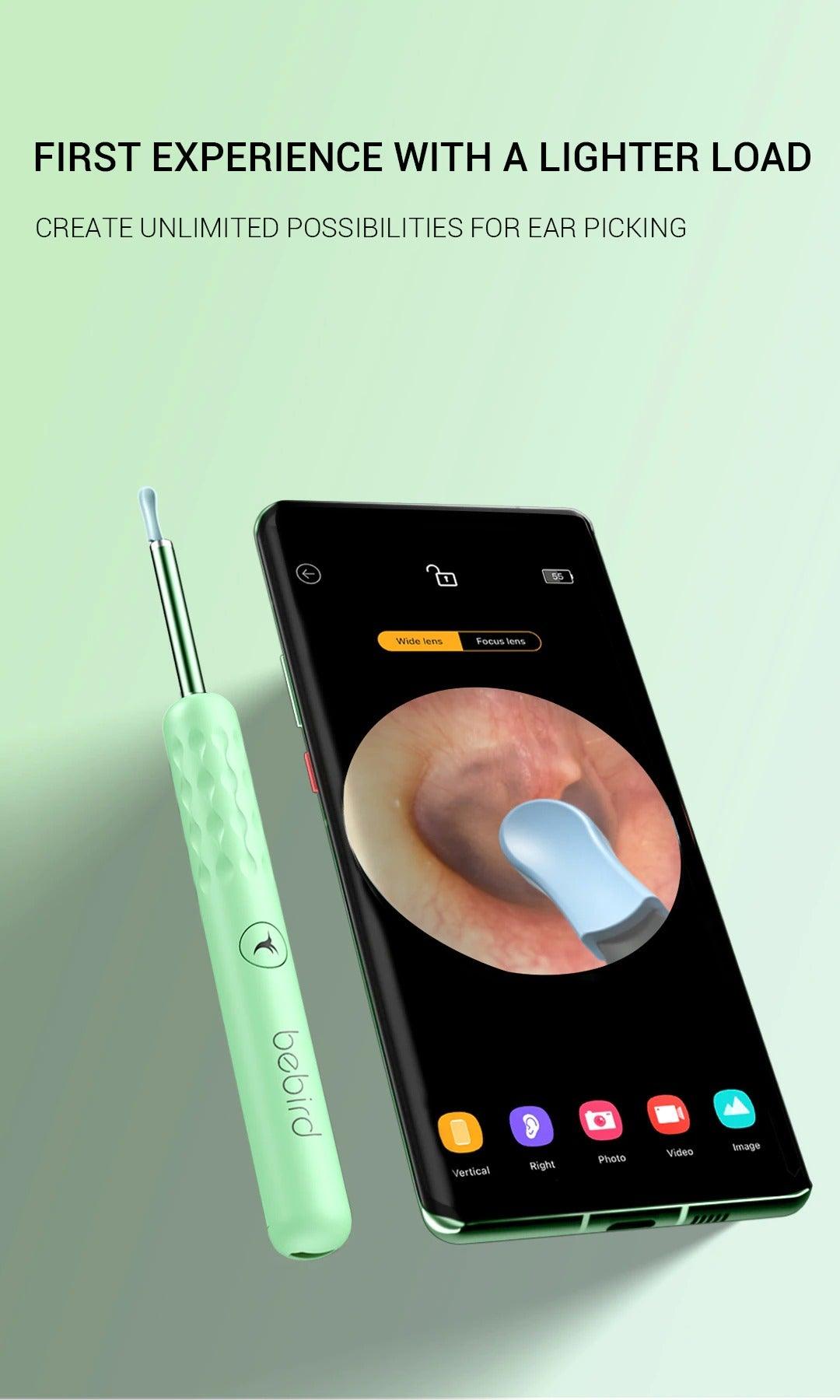 Lisslune | Smart Visual Endoscope