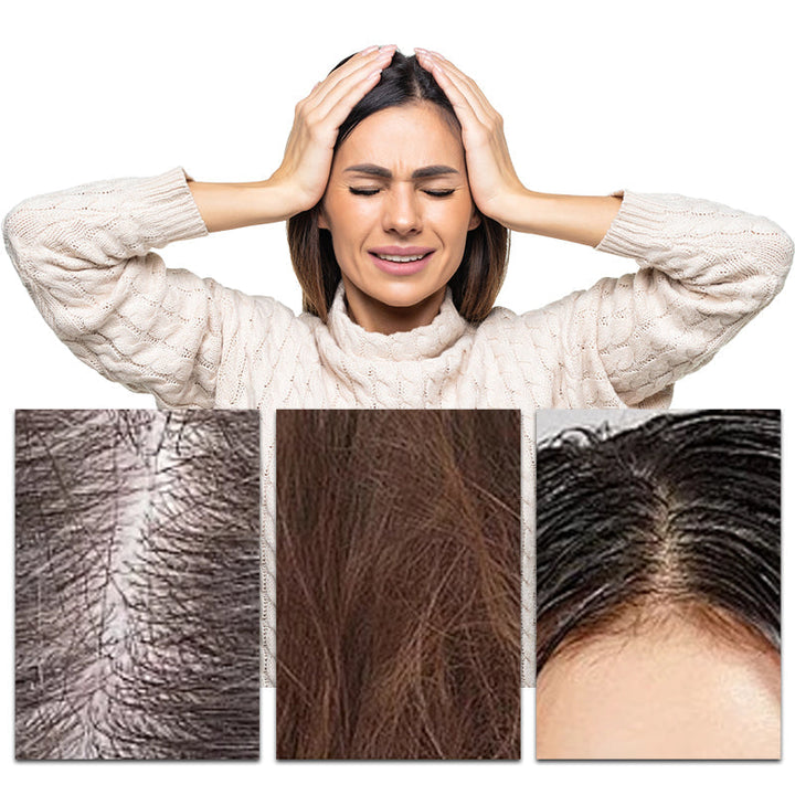 Lisslune | Buy 3 and get 2 free - Deep Moisturizing Shampoo