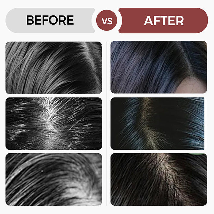 Lisslune | Buy 3 and get 2 free - Deep Moisturizing Shampoo