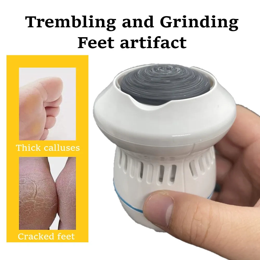 Lisslune | Vacuum Callus Remover